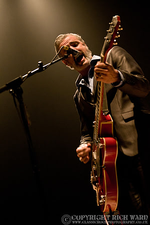 Triggerfinger